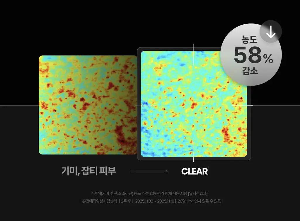 [미백/잡티케어] 가쉬 타겟티드 브라이트닝 겔 미스트 100ml 상세페이지 15